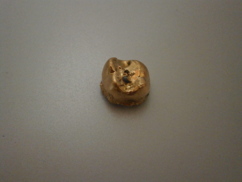 金牙收購