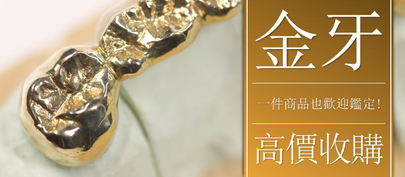 金牙高價收購